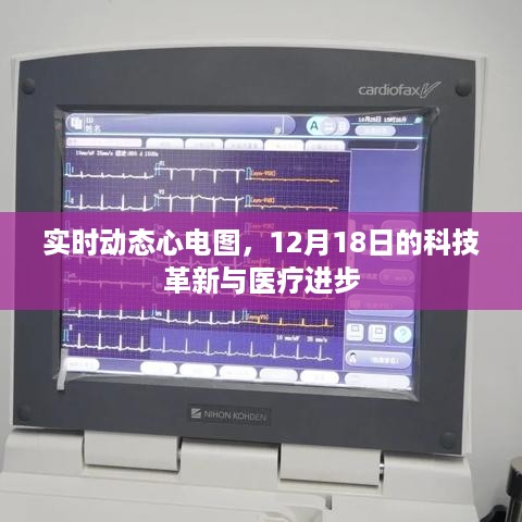 实时动态心电图，科技革新与医疗进步的里程碑（12月18日）