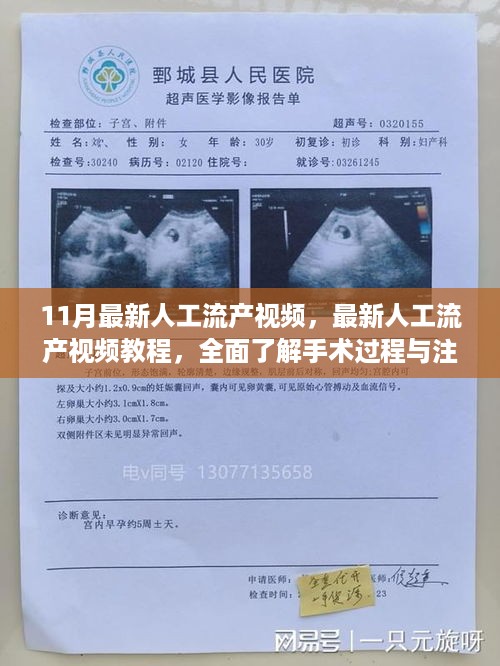 最新人工流产视频教程，全面了解手术过程与注意事项