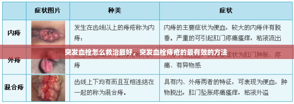 突发血栓怎么救治最好，突发血栓痔疮的最有效的方法 